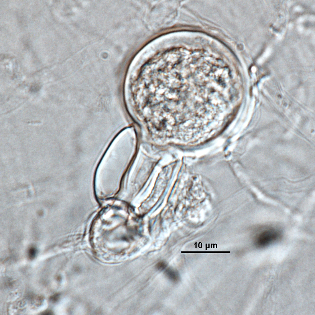   Phytophthora ramorumnbsp; (ex-type CPHST BL 55G)nbsp;sexual phase: plerotic oospore of ex-type (A1, EU1) produced with tester strainnbsp; P. capsicinbsp; (A2, ex-type CPHST BL 33); photo by Gloria Abad, USDA-APHIS-PPQ. 
